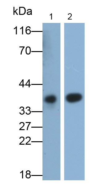 Monoclonal Antibody to Retinaldehyde Binding Protein 1 (RLBP1)