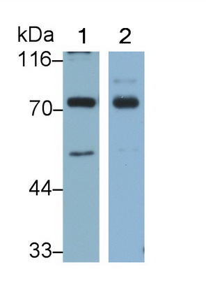 Monoclonal Antibody to Tumor Protein P63 (TP63)