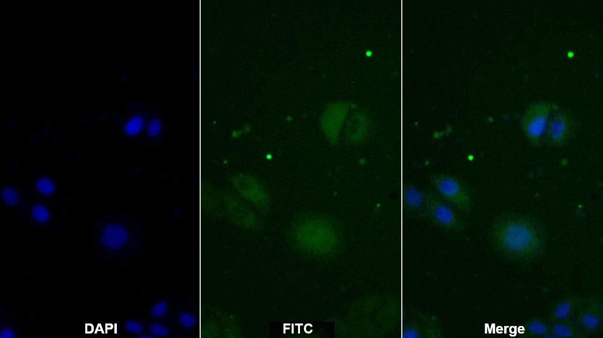 Monoclonal Antibody to Thymidine Kinase 1, Soluble (TK1)
