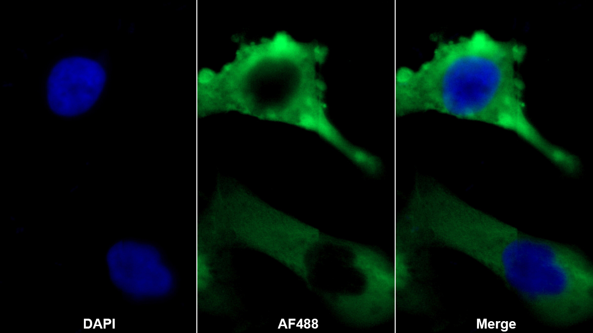 Monoclonal Antibody to Dermcidin (DCD)