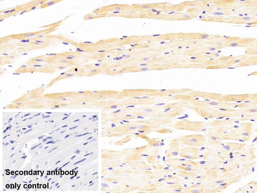 Monoclonal Antibody to Crystallin Alpha B (CRYaB)
