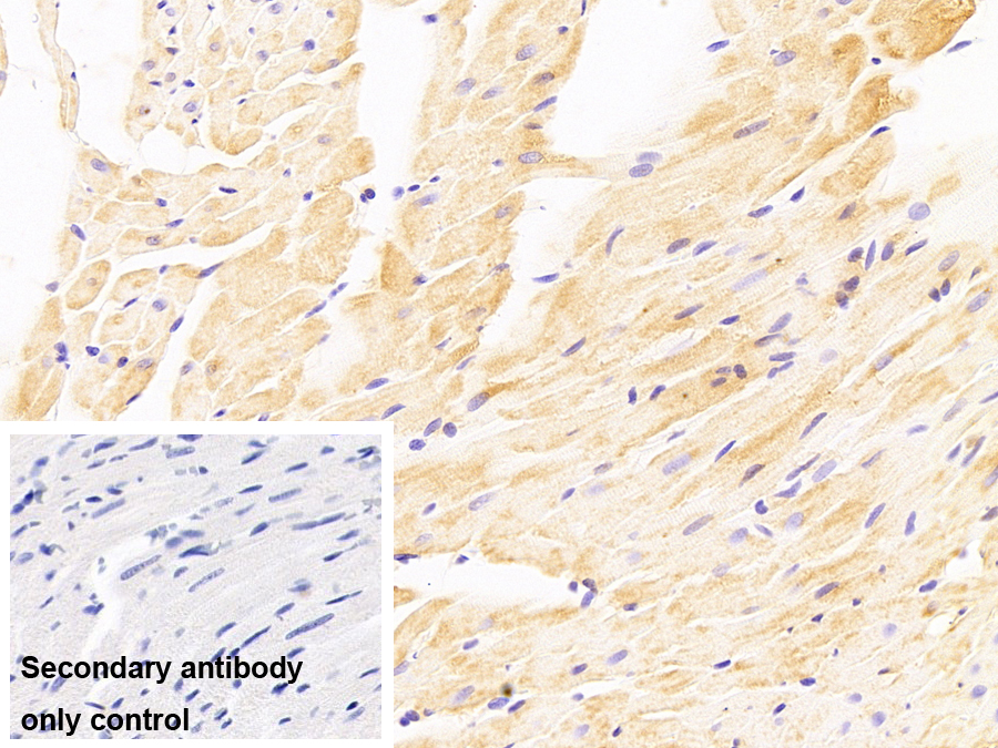 Monoclonal Antibody to Crystallin Alpha B (CRYaB)