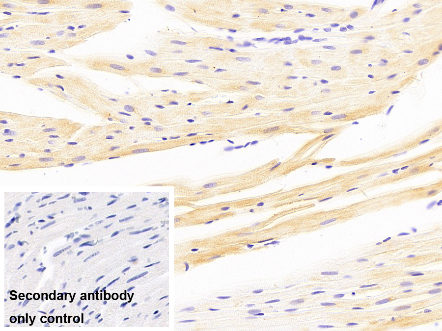 Monoclonal Antibody to Crystallin Alpha B (CRYaB)