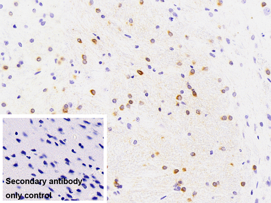 Monoclonal Antibody to Crystallin Alpha B (CRYaB)