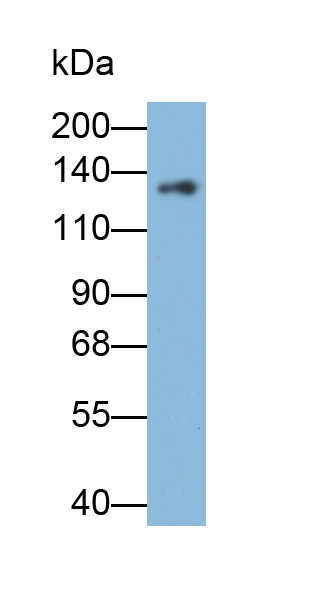 Monoclonal Antibody to Myosin Binding Protein C, Cardiac (MYBPC3)