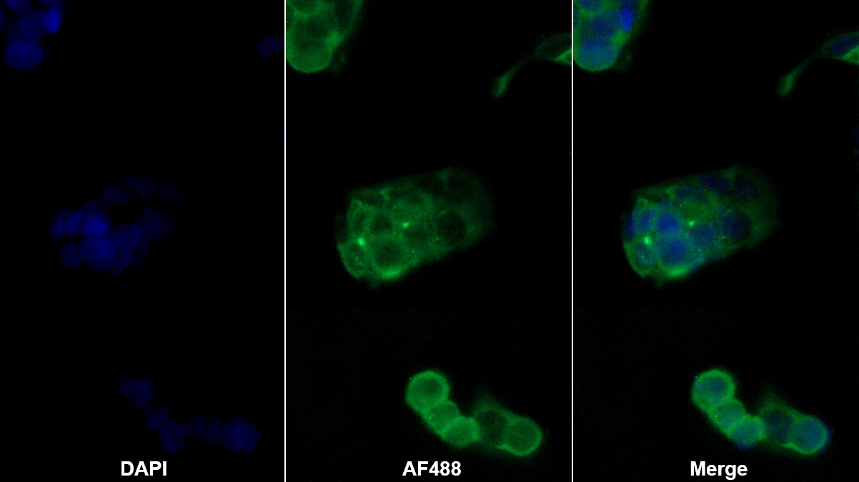 Monoclonal Antibody to Ferritin, Light Polypeptide (FTL)