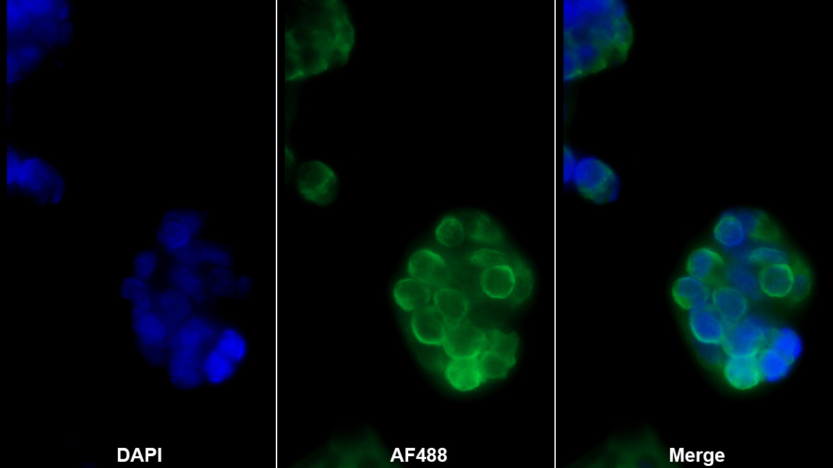 Monoclonal Antibody to Ferritin, Light Polypeptide (FTL)