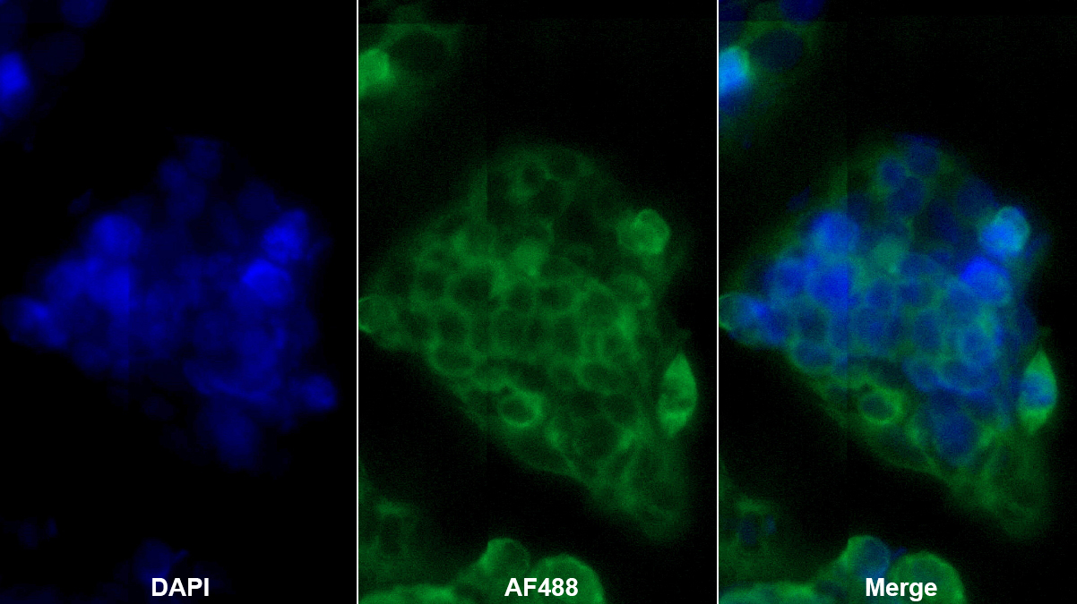 Monoclonal Antibody to Ferritin, Light Polypeptide (FTL)