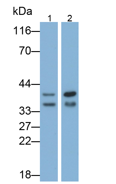 Monoclonal Antibody to Carbonic Anhydrase XII (CA12)