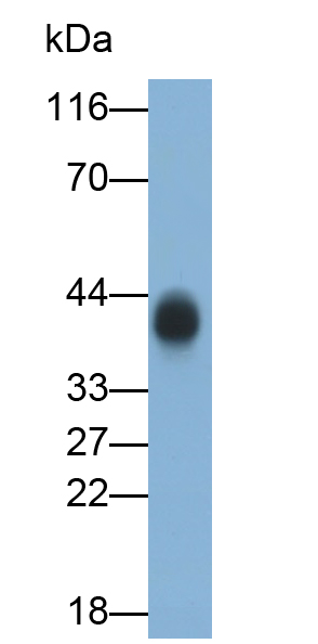 Monoclonal Antibody to Carbonic Anhydrase XII (CA12)