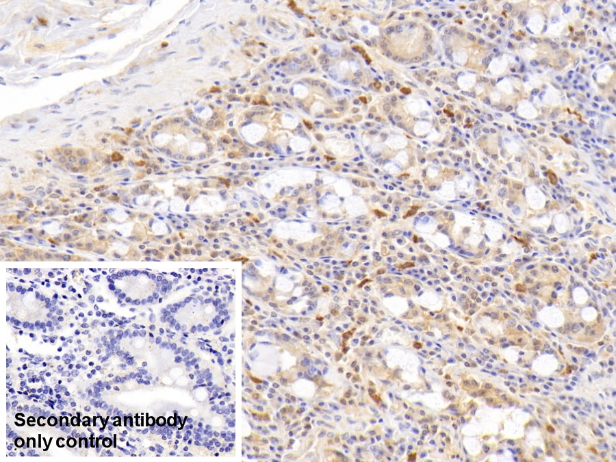 Monoclonal Antibody to Ribonuclease A2 (RNASE2)