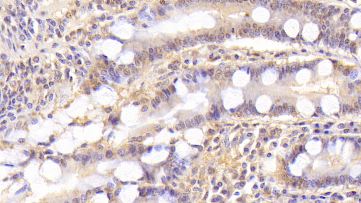 Monoclonal Antibody to Syntenin 2 (ST2)