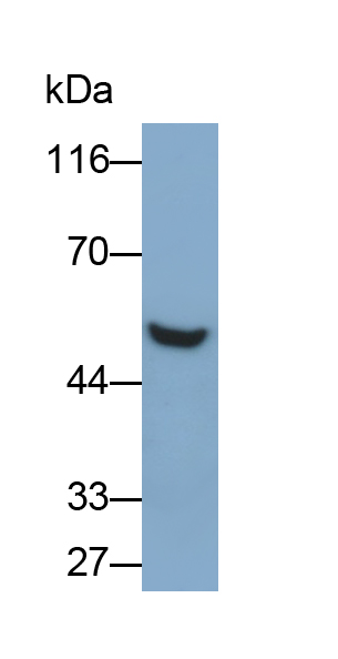 Monoclonal Antibody to Mucin 21 (MUC21)
