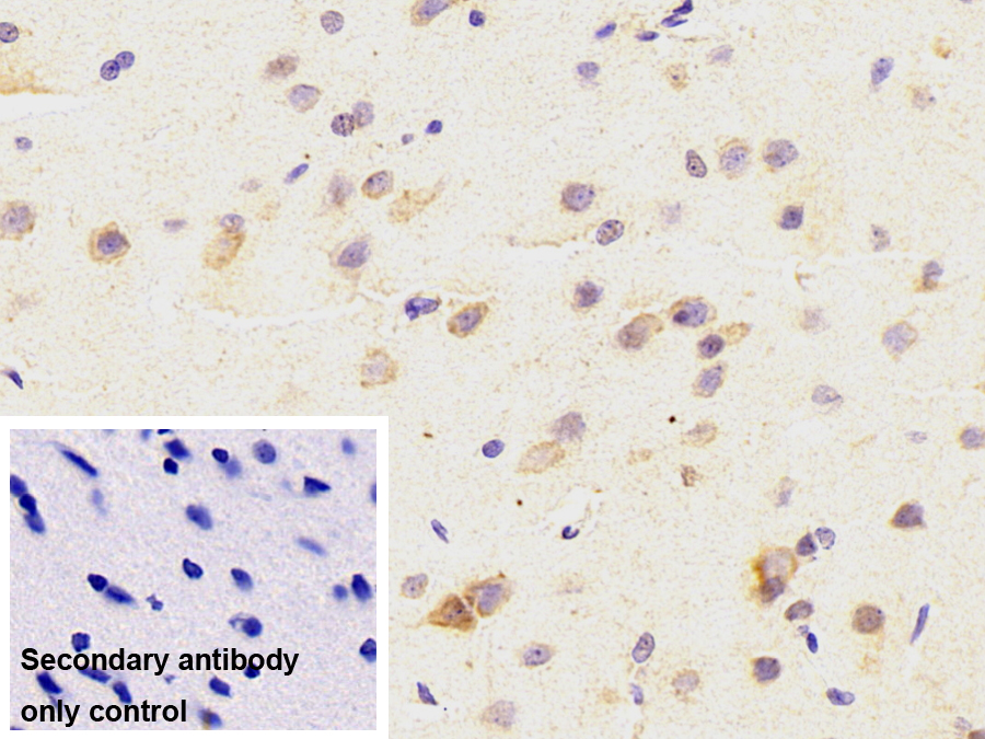 Monoclonal Antibody to Transportin 2 (TNPO2)