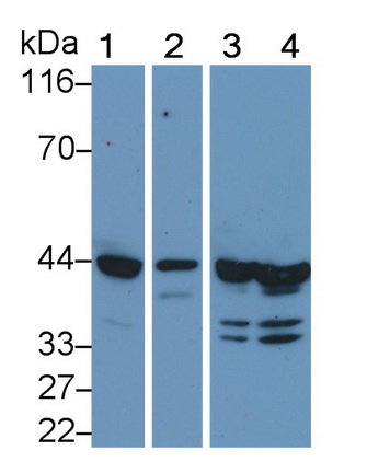 Monoclonal Antibody to Troponin T Type 2, Cardiac (TNNT2)