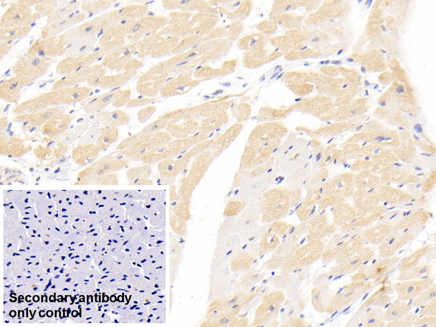 Monoclonal Antibody to Troponin T Type 2, Cardiac (TNNT2)