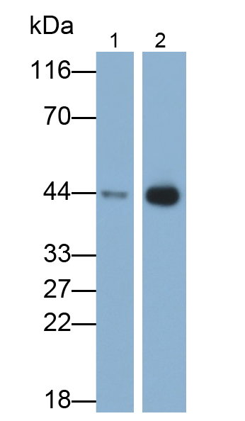 Monoclonal Antibody to Troponin T Type 2, Cardiac (TNNT2)