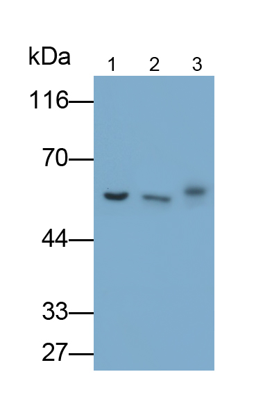 Monoclonal Antibody to Keratin 6A (KRT6A)