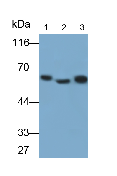Monoclonal Antibody to Keratin 6A (KRT6A)
