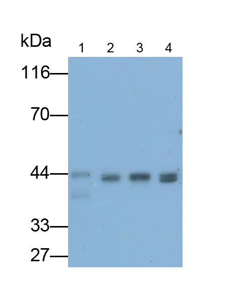Monoclonal Antibody to Casein Kinase 1 Delta (CSNK1d)