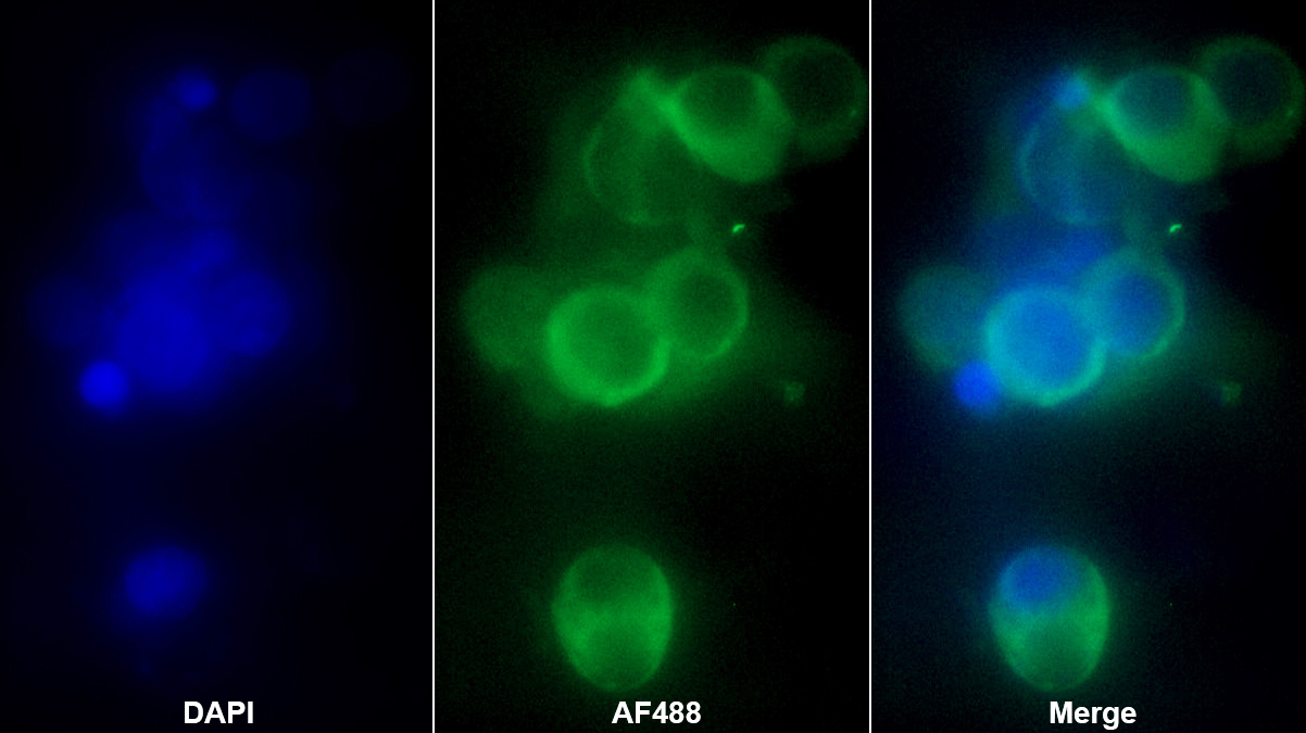 Monoclonal Antibody to Casein Kinase 1 Delta (CSNK1d)