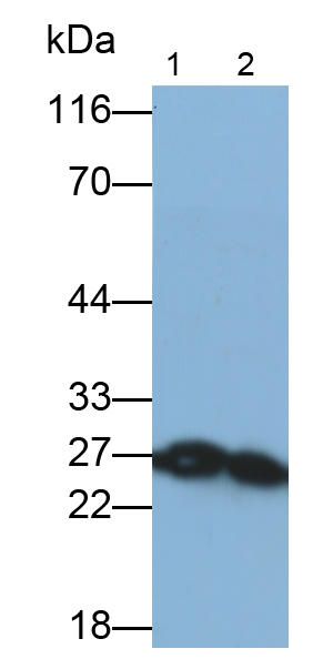Monoclonal Antibody to Myosin Light Chain 3, Alkali, Ventricular, Slow Skeletal (MYL3)