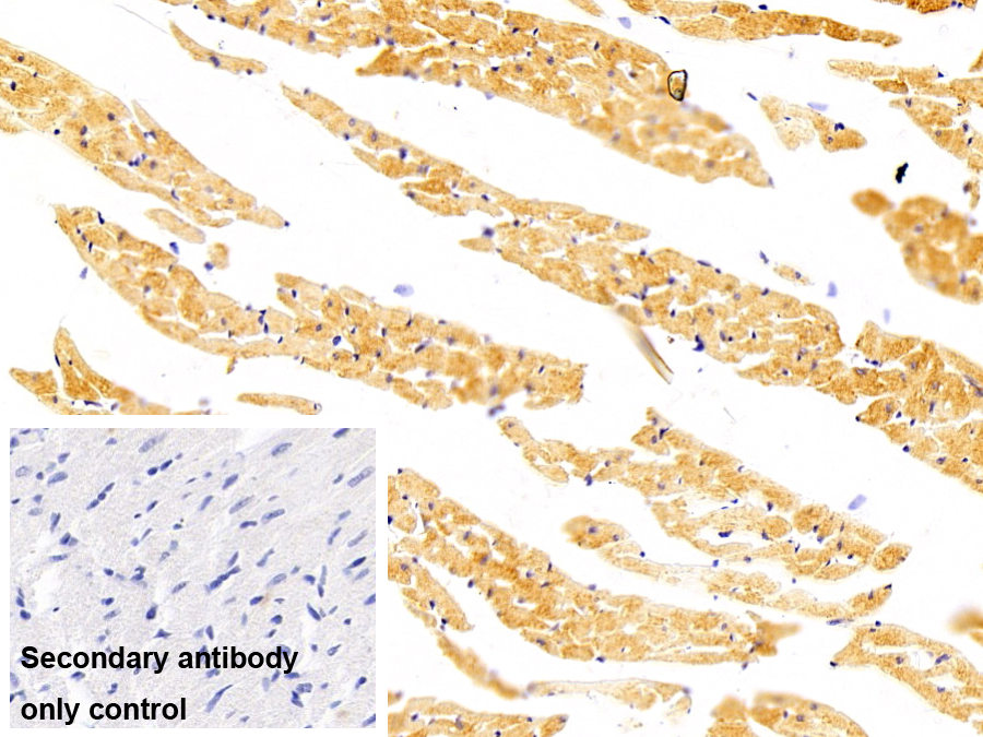 Monoclonal Antibody to Myosin Light Chain 3, Alkali, Ventricular, Slow Skeletal (MYL3)
