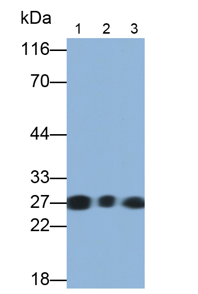 Monoclonal Antibody to Myosin Light Chain 3, Alkali, Ventricular, Slow Skeletal (MYL3)