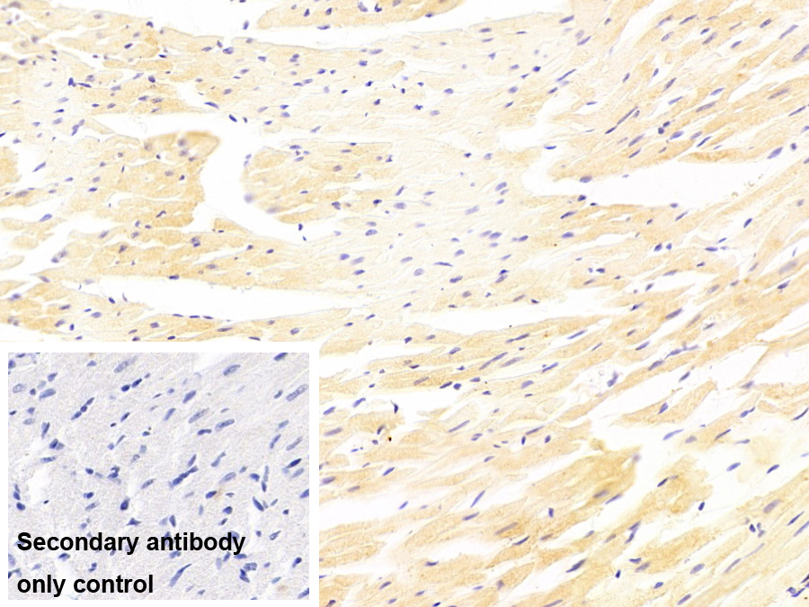 Monoclonal Antibody to Myosin Light Chain 3, Alkali, Ventricular, Slow Skeletal (MYL3)