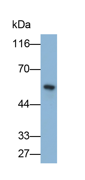 Monoclonal Antibody to Glutathione Synthetase (GSS)