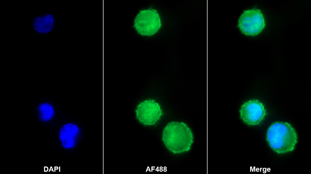 Monoclonal Antibody to Glutathione Synthetase (GSS)