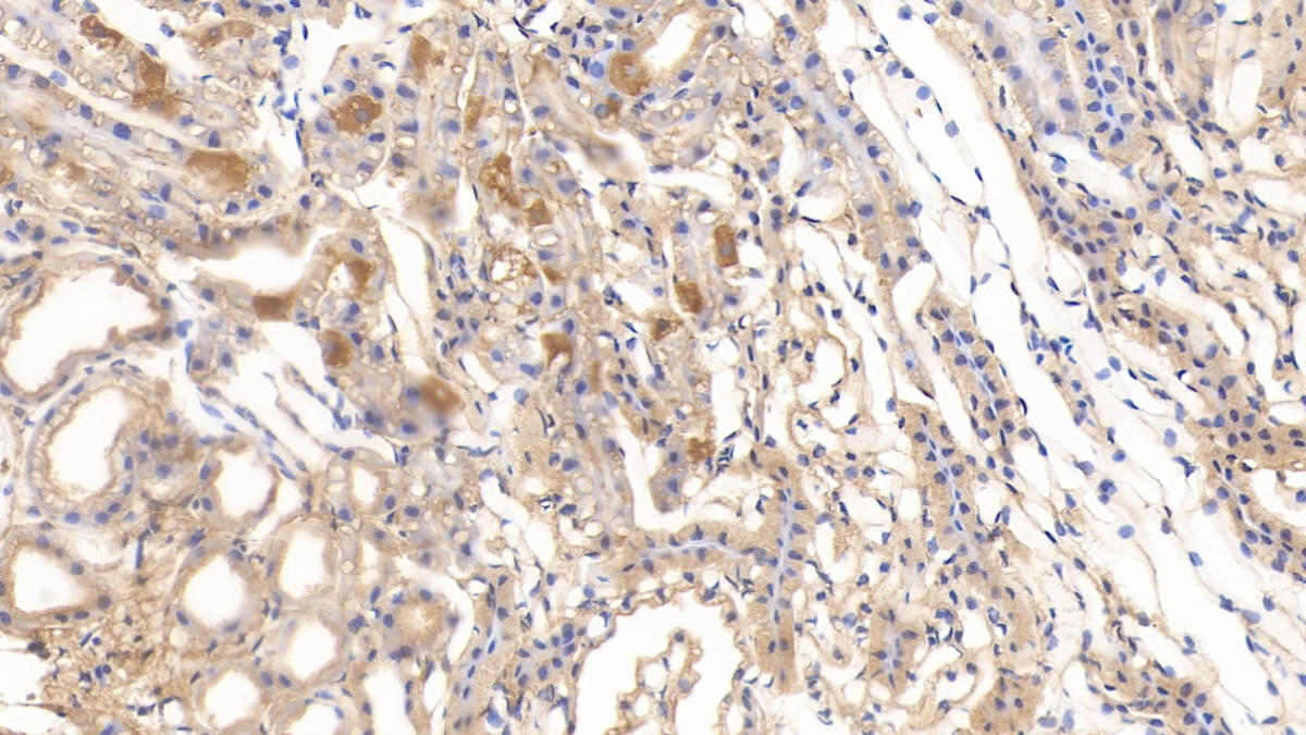 Monoclonal Antibody to Deoxythymidylate Kinase (DTYMK)