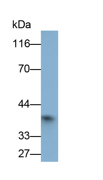 Monoclonal Antibody to Arginase II (Arg2)