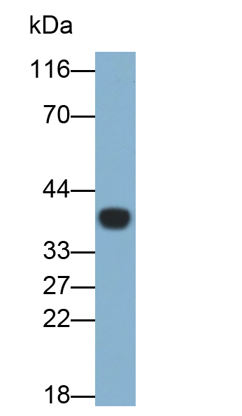 Monoclonal Antibody to Arginase II (Arg2)
