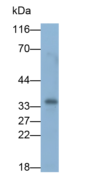 Monoclonal Antibody to Basic Salivary Proline Rich Protein 1 (PRB1)