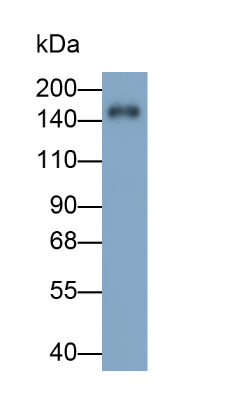 Monoclonal Antibody to Thrombospondin 2 (THBS2)