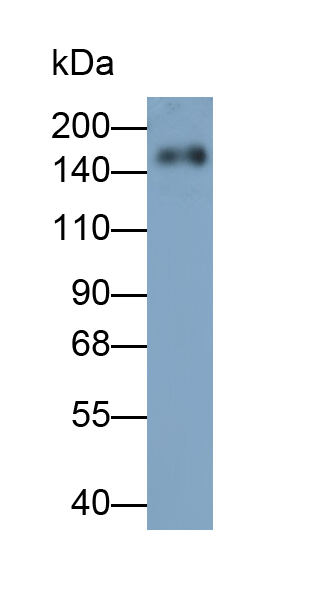 Monoclonal Antibody to Thrombospondin 2 (THBS2)