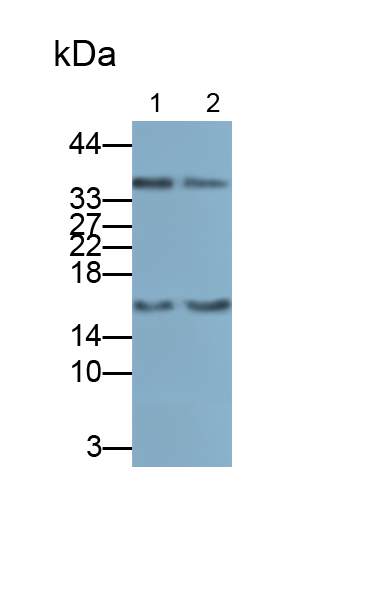 Monoclonal Antibody to Phospholipase A2, Group IIA (PLA2G2A)