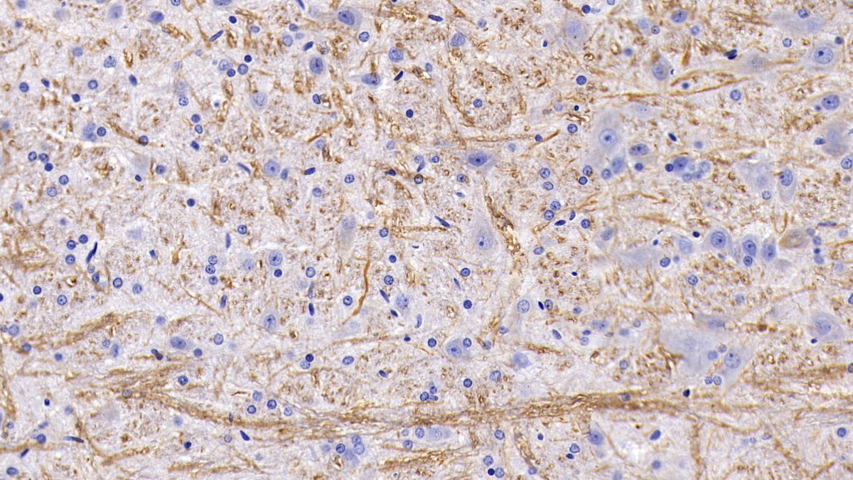 Monoclonal Antibody to Neurofilament, Light Polypeptide (NEFL)