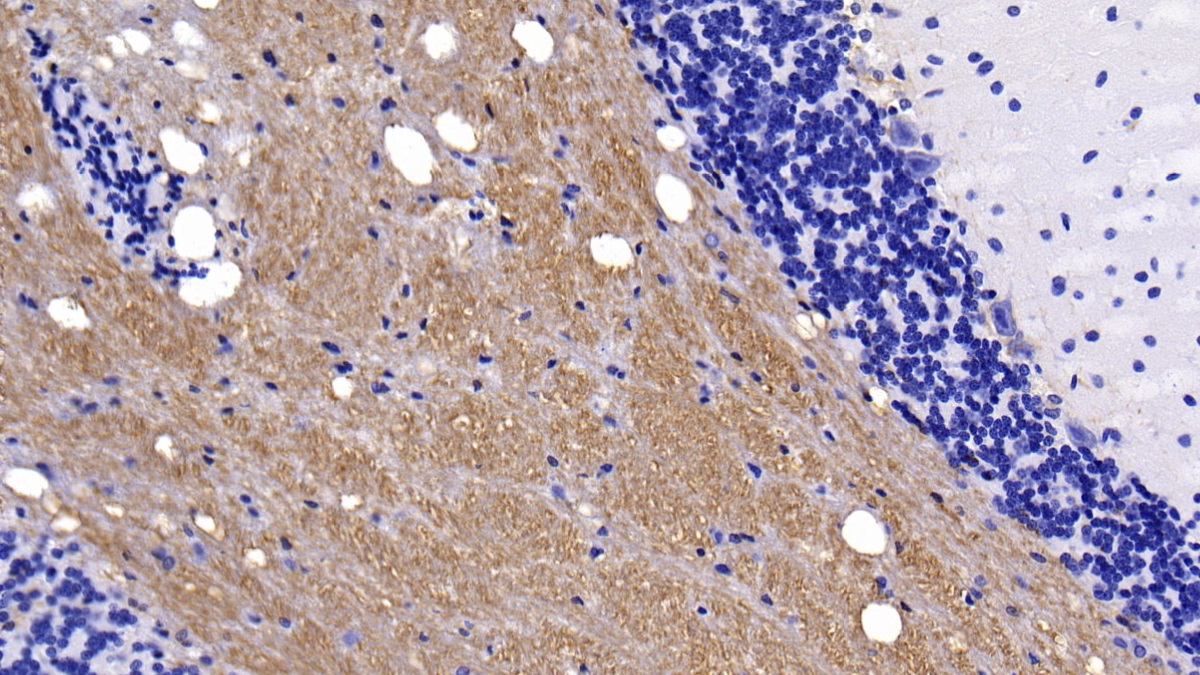 Monoclonal Antibody to Neurofilament, Light Polypeptide (NEFL)