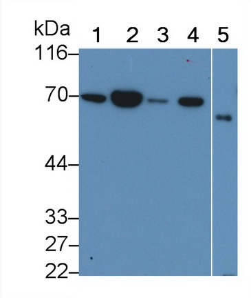 Monoclonal Antibody to Neurofilament, Light Polypeptide (NEFL)