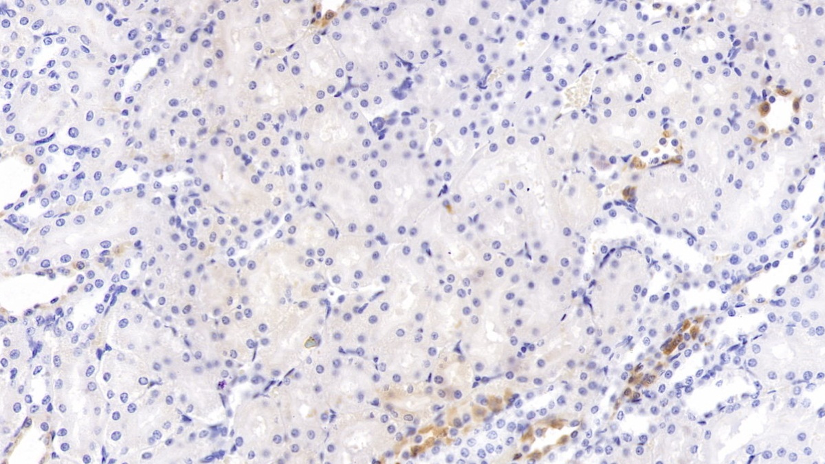 Monoclonal Antibody to Proprotein Convertase Subtilisin/Kexin Type 9 (PCSK9)