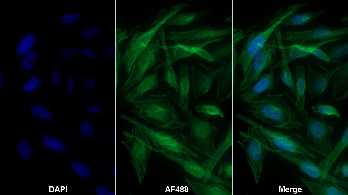 Monoclonal Antibody to Alpha-1-B-Glycoprotein (a1BG)
