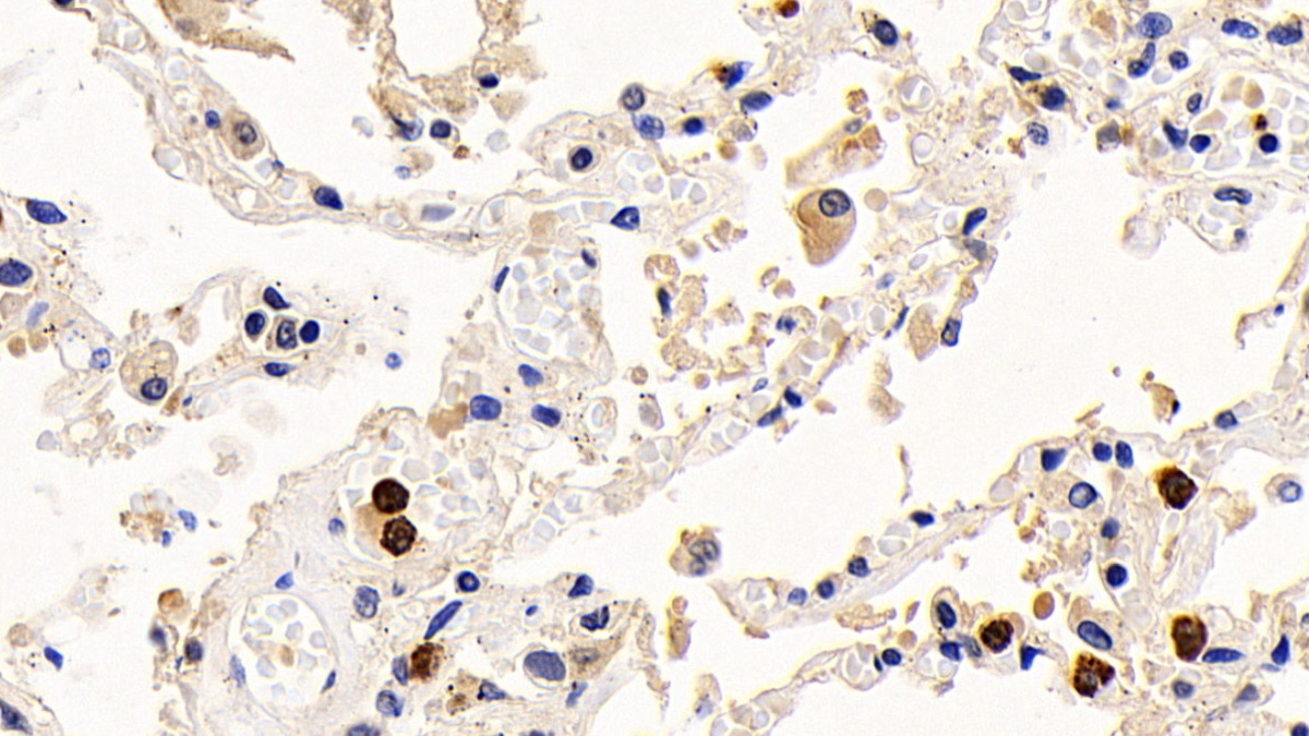 Monoclonal Antibody to B-Cell CLL/Lymphoma 2 Like Protein (Bcl2L)