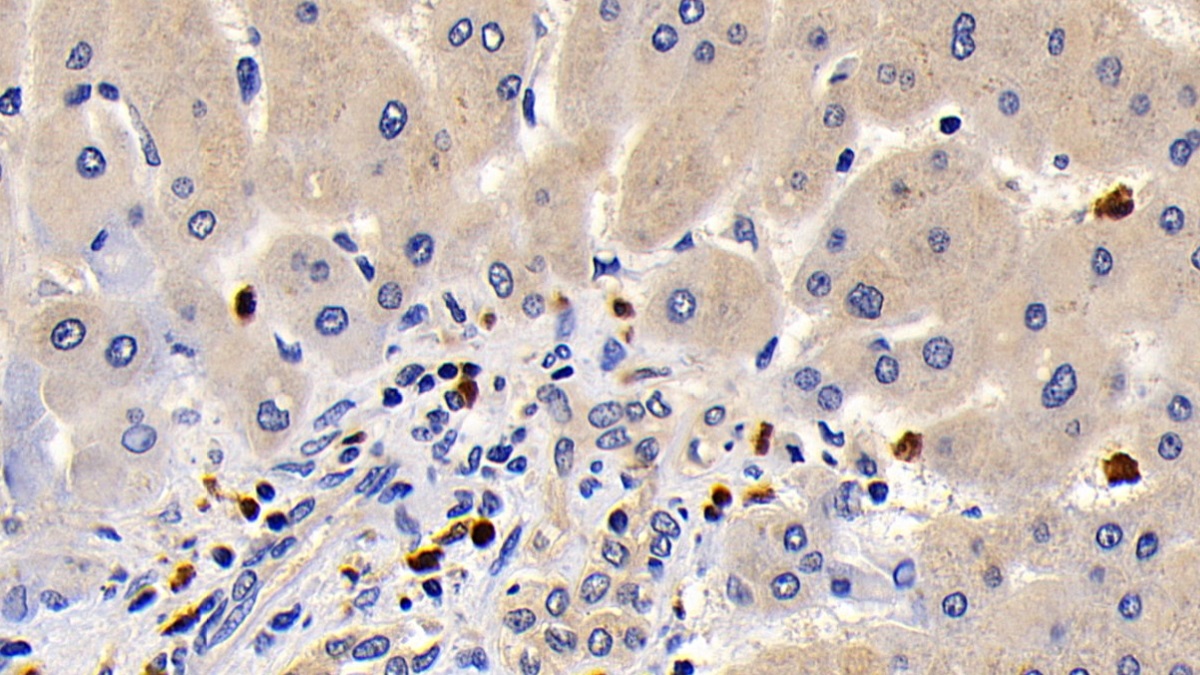 Monoclonal Antibody to B-Cell CLL/Lymphoma 2 Like Protein (Bcl2L)