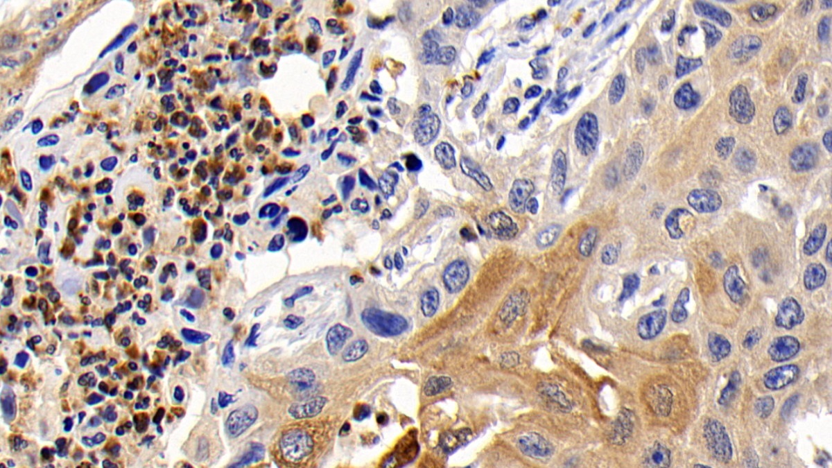 Monoclonal Antibody to B-Cell CLL/Lymphoma 2 Like Protein (Bcl2L)