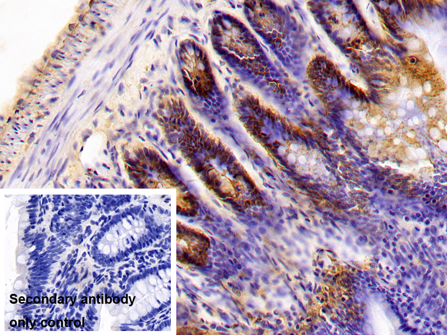 Monoclonal Antibody to B-Cell CLL/Lymphoma 2 Like Protein (Bcl2L)