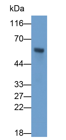 Monoclonal Antibody to Receptor Interacting Serine Threonine Kinase 3 (RIPK3)