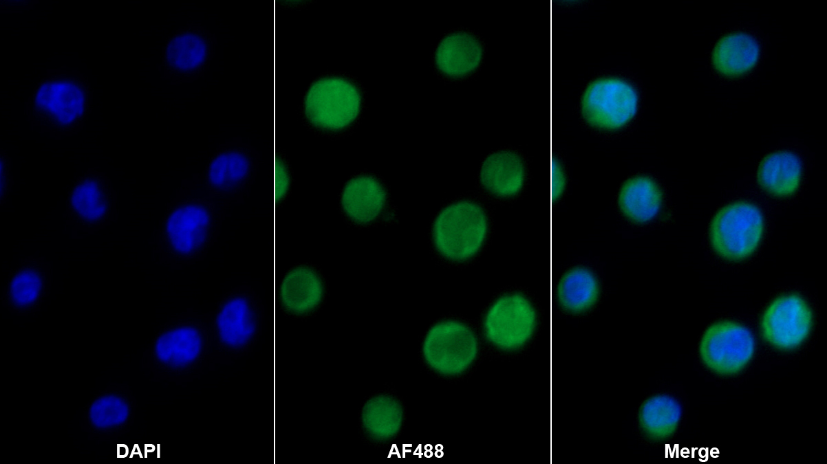 Monoclonal Antibody to Inhibitory Subunit Of NF Kappa B Epsilon (IkBe)