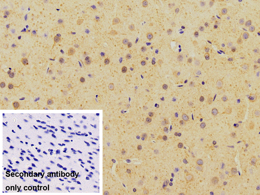 Monoclonal Antibody to Tubulin Beta 3 (TUBb3)